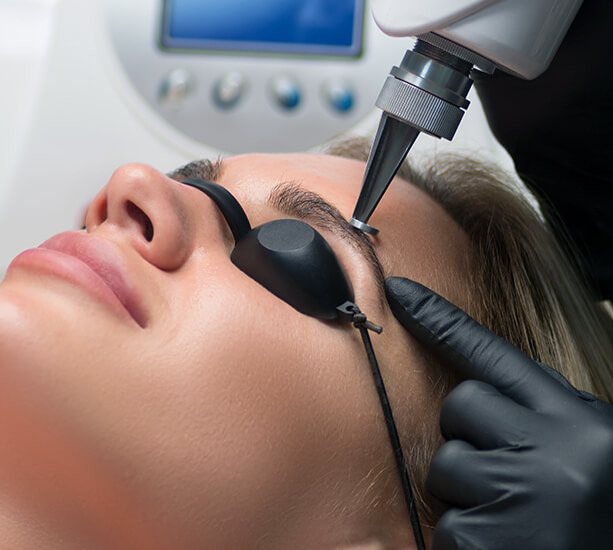 Détatouage au Laser Picosecond, tatto, tatouage ennuyé, tatouage foiré, tatouage fané, Tanguy, Lausane, 1004, Avogadro Institut de Beauté