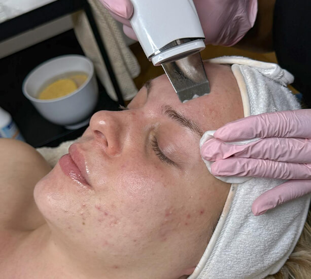 soin du visage, soin nettoyant, soin hydratant, soin anti-âge, beauté, institut de beauté, institut soin du visage, summecosmetics institut, esthéticienne, nettoyage de la peau, type de peau, Avogadro, Lausanne