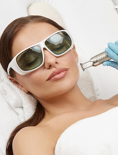 Traitement laser anti âge visage à Lausanne pour une peau plus lisse, lumineuse et uniforme